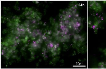 Microcolony development on T. pseudonana particles – Shaelyn Silverman