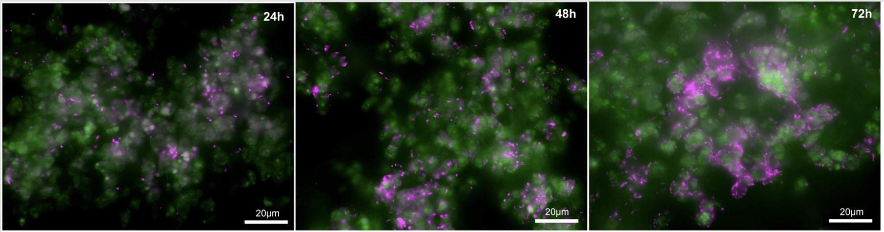 Microcolony development on T. pseudonana particles – Shaelyn Silverman