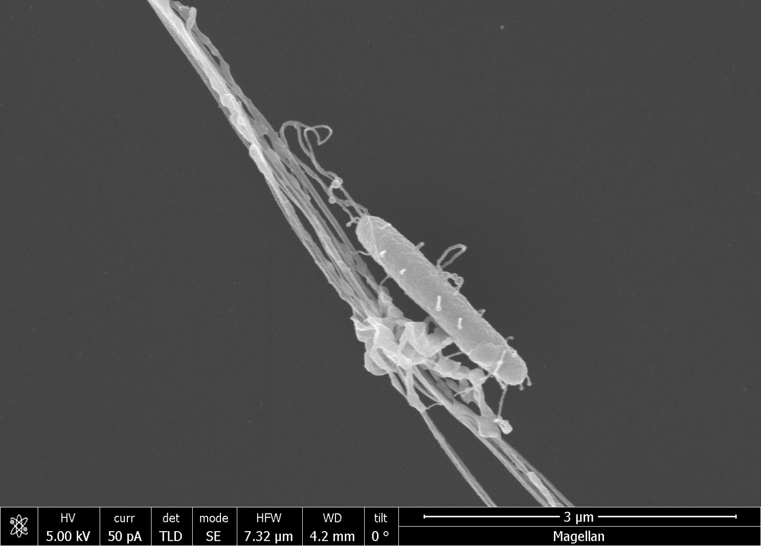 Microscale dynamics of bacteria-spines interactions – Mathieu Forget